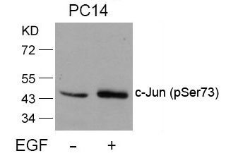 c-Jun (Phospho-Ser73) Antibody