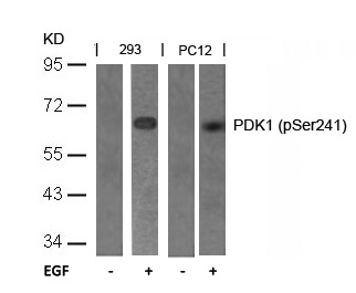 PDK1 (Phospho-Ser241) Antibody