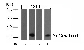 MEK-2 (Phospho-Thr394) Antibody