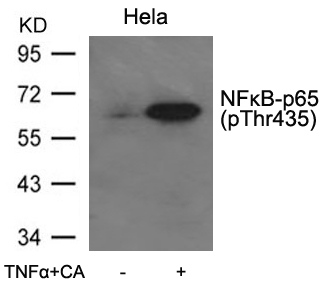 NFκB-p65(Phospho-Thr435) Antibody