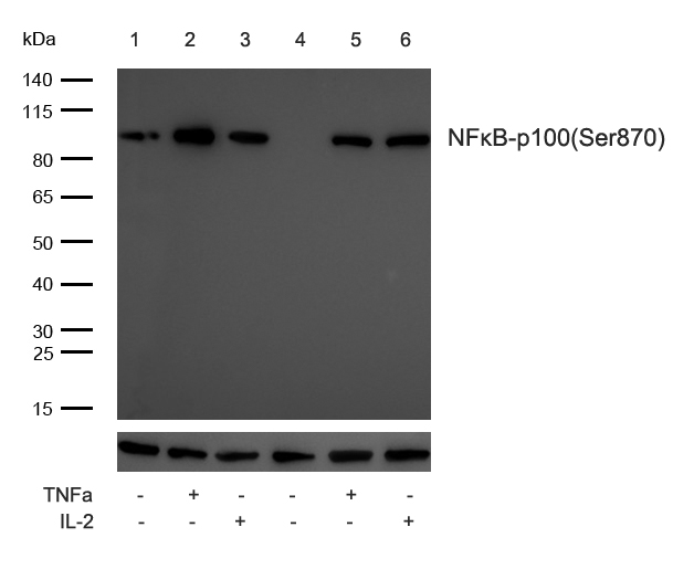 NFκB-p100/p52(Phospho-Ser870) Antibody