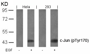 c-Jun (Phospho-Tyr170) Antibody