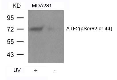 ATF2 (Phospho-Ser62 or 44) Antibody