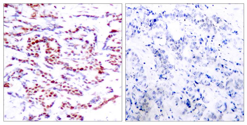 ATF2 (Phospho-Thr71 or 53) Antibody