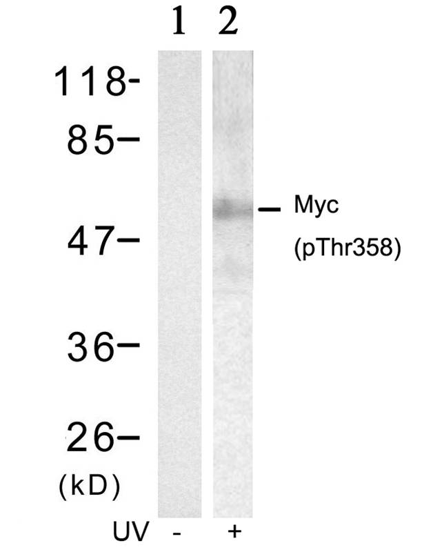 Myc (Phospho-Thr358) Antibody