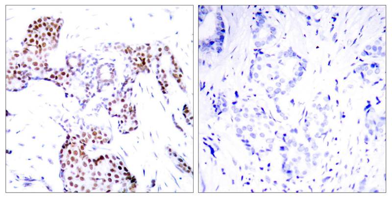 Elk1 (Phospho-Ser389) Antibody
