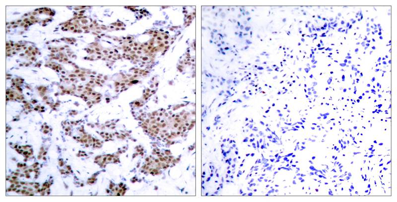 MEF2A (Phospho-Thr312) Antibody