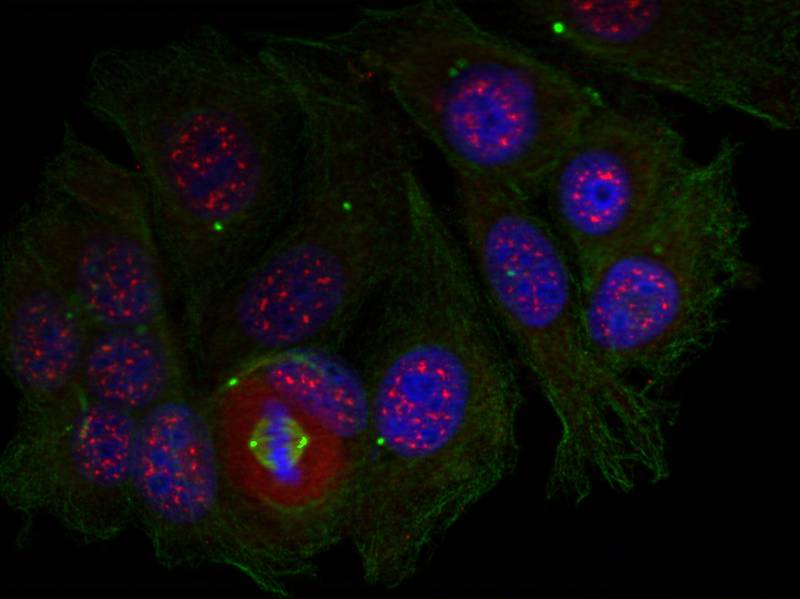MEF2A (Phospho-Thr319) Antibody