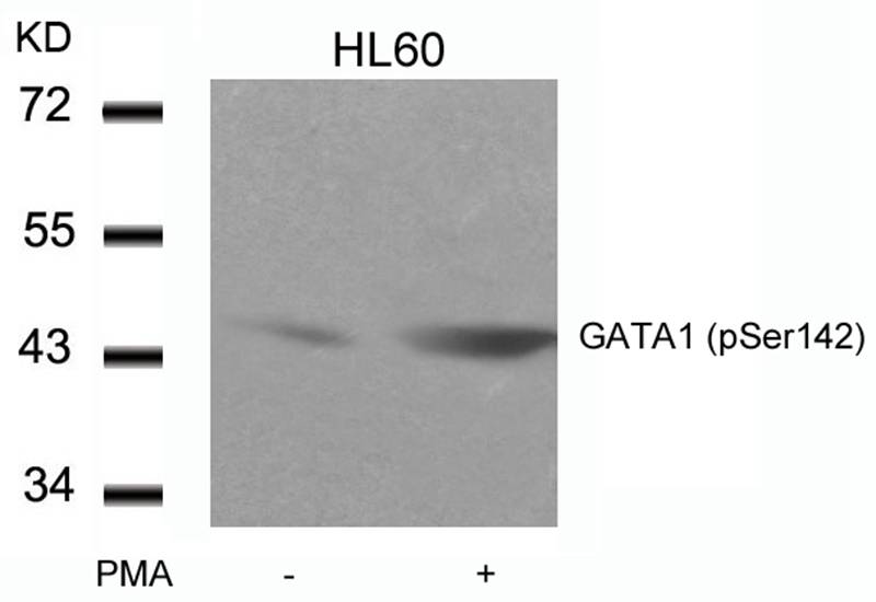 GATA1 (Phospho-Ser142) Antibody