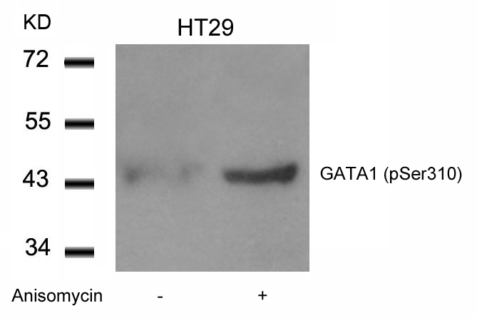 GATA1 (Phospho-Ser310) Antibody