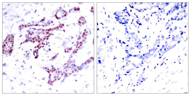 STAT1 (Phospho-Tyr701) Antibody