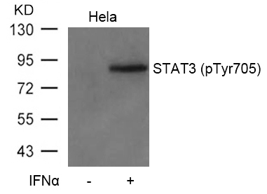 STAT3 (Phospho-Tyr705) Antibody