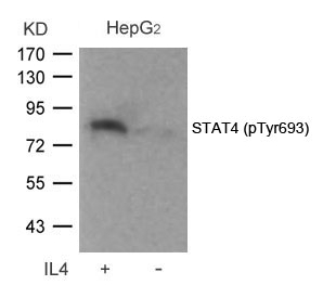 STAT4 (Phospho-Tyr693) Antibody
