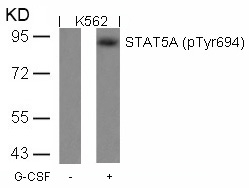 STAT5A (Phospho-Tyr694) Antibody