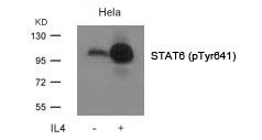 STAT6 (Phospho-Tyr641) Antibody