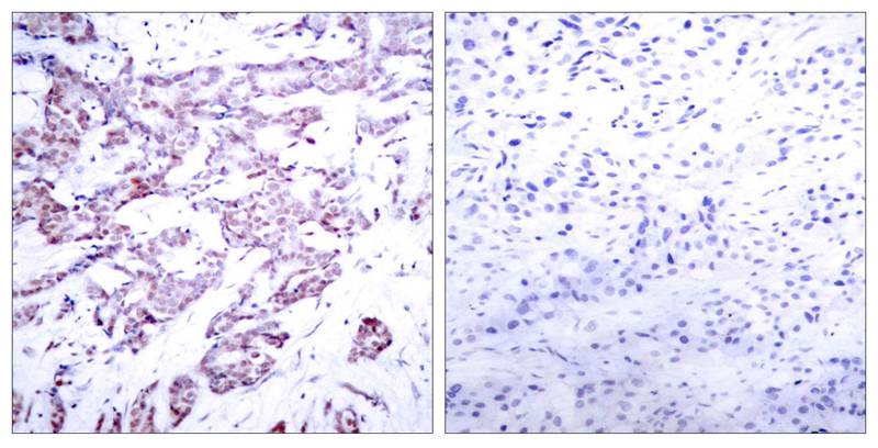 STAT6 (Phospho-Thr645) Antibody