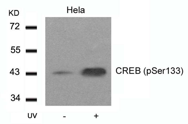 CREB (Phospho-Ser133) Antibody