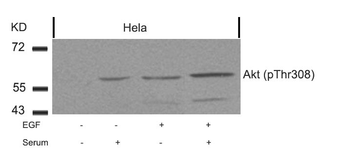 Akt (Phospho-Thr308) Antibody