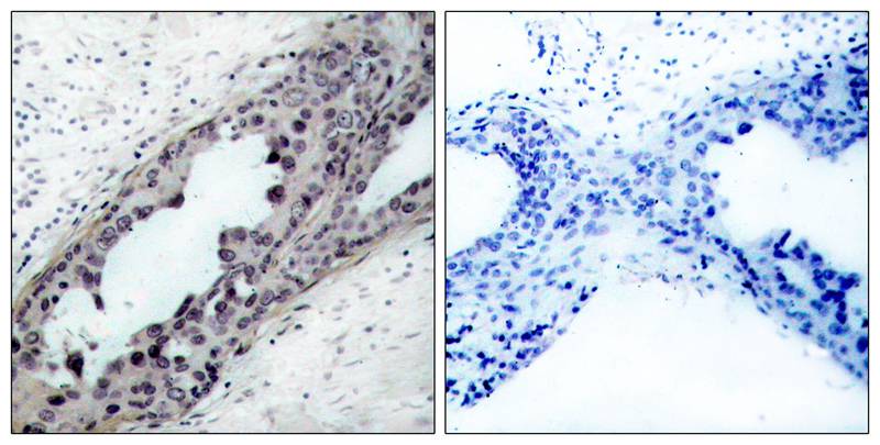 PTEN (Phospho-Ser380/Thr382/Thr383) Antibody