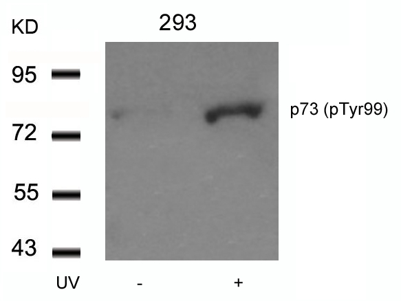p73 (Phospho-Tyr99) Antibody