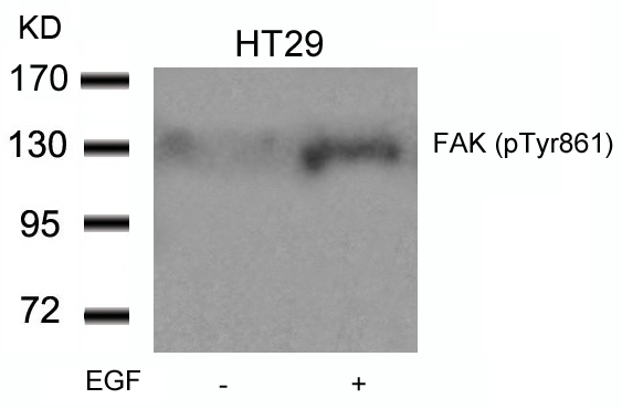 FAK (Phospho-Tyr861) Antibody