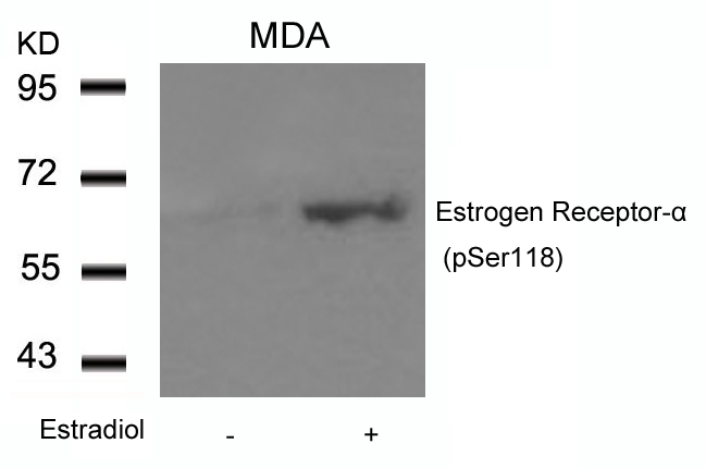 Estrogen Receptor-α (Phospho-Ser118) Antibody