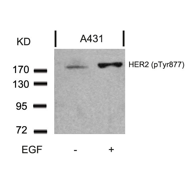HER2 (Phospho-Tyr877) Antibody