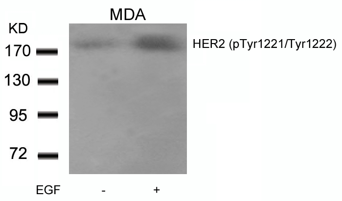 HER2 (Phospho-Tyr1221/Tyr1222) Antibody