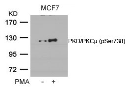PKD/PKCμ (Phospho-Ser738) Antibody
