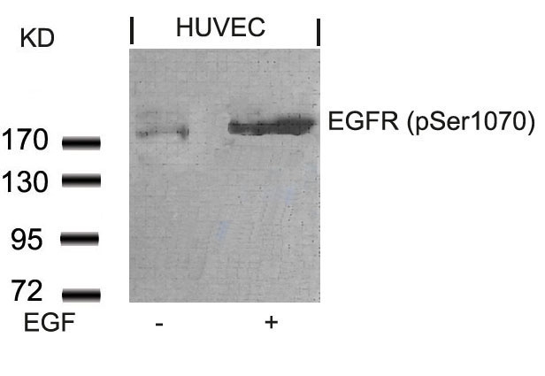 EGFR (Phospho-Ser1070) Antibody
