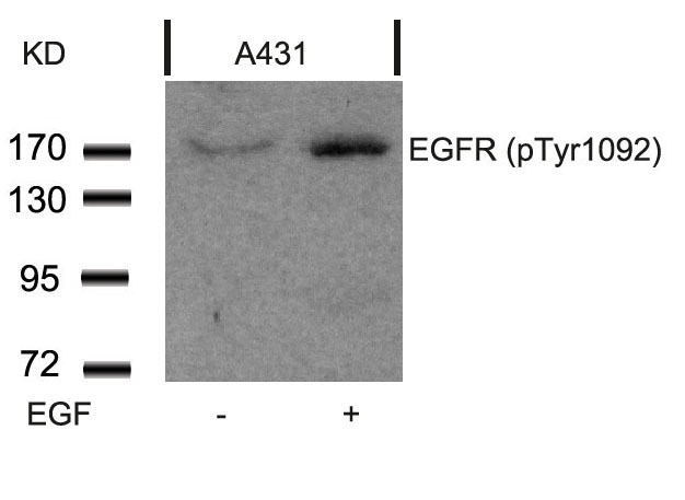 EGFR (Phospho-Tyr1092) Antibody
