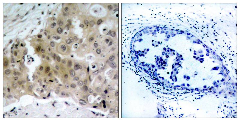 VEGFR2 (Phospho-Tyr1175) Antibody