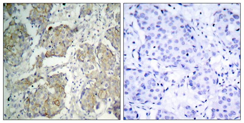 VEGFR2 (Phospho-Tyr1214) Antibody