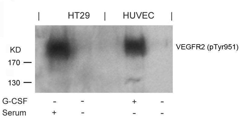 VEGFR2 (Phospho-Tyr951) Antibody
