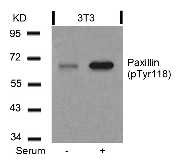 Paxillin (Phospho-Tyr118) Antibody