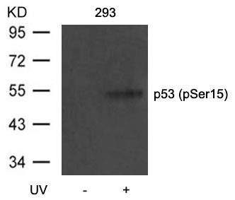 p53 (Phospho-Ser15) Antibody