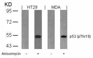 p53 (Phospho-Thr18) Antibody