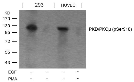 PKD/PKCμ (Phospho-Ser910) Antibody