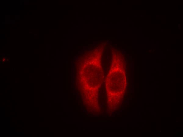p53 (Phospho-Ser37) Antibody