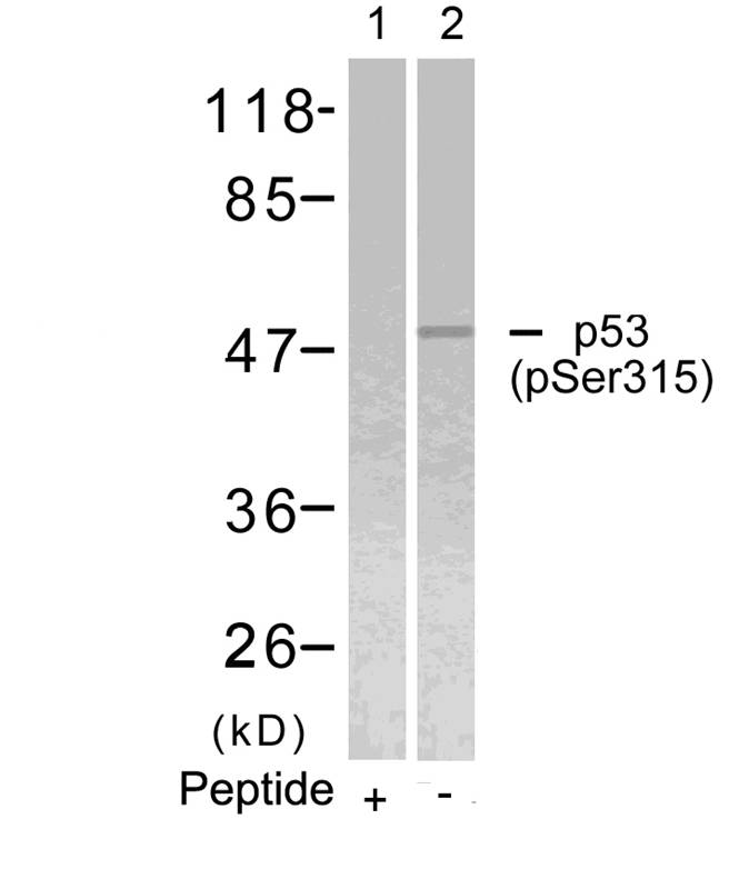p53 (Phospho-Ser315) Antibody