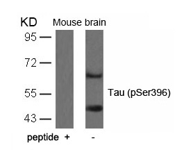 Tau (Phospho-Ser396) Antibody