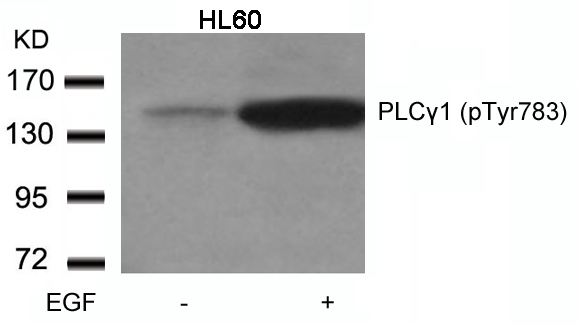 PLCγ1 (Phospho-Tyr783) Antibody