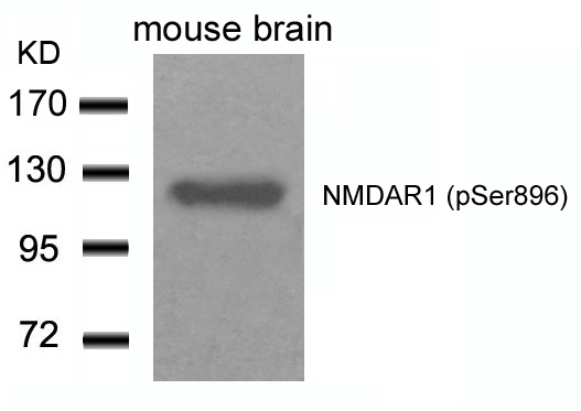 NMDAR1 (Phospho-Ser896) Antibody