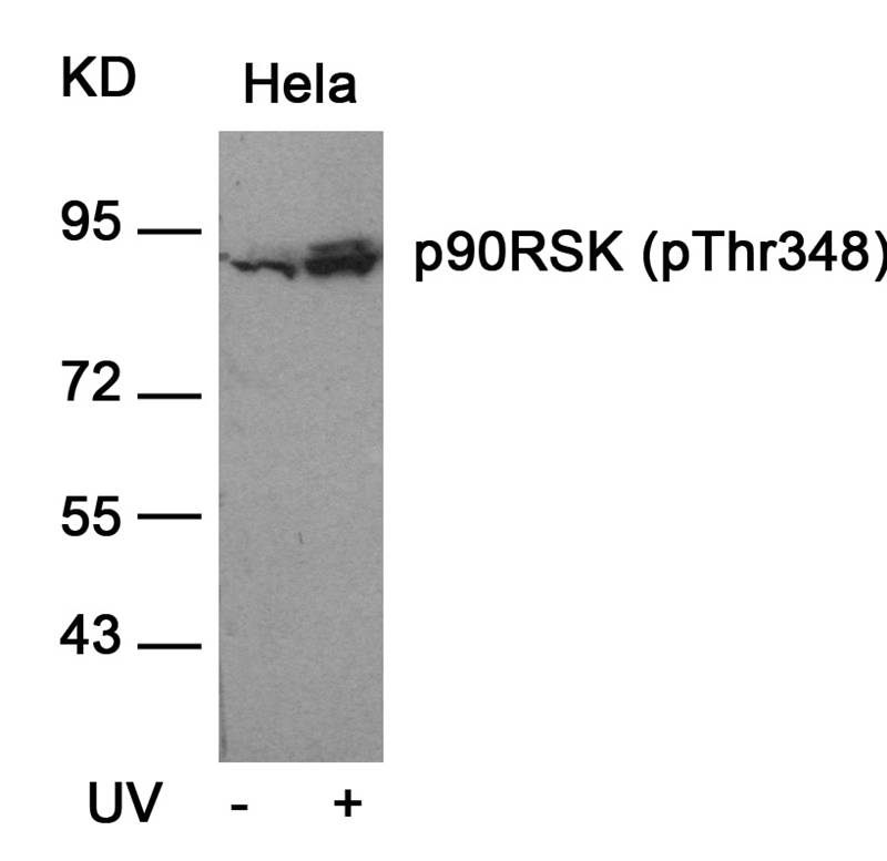 p90RSK (Phospho-Thr348) Antibody