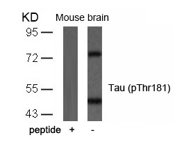 Tau (Phospho-Thr181) Antibody