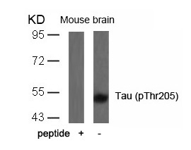 Tau (Phospho-Thr205) Antibody
