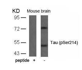 Tau (Phospho-Ser214) Antibody