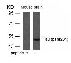 Tau (Phospho-Thr231) Antibody