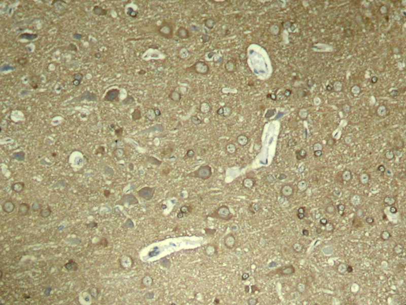 Tau (Phospho-Ser404) Antibody
