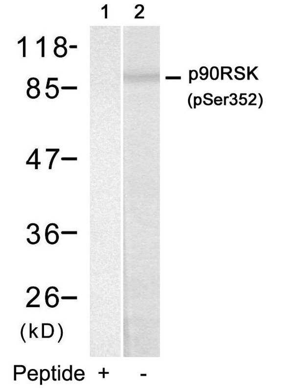 p90RSK (Phospho-Ser352) Antibody